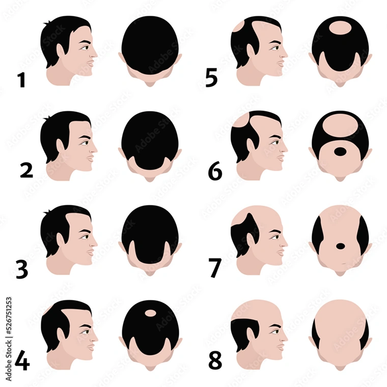 male hair table