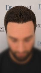 Patient after 9